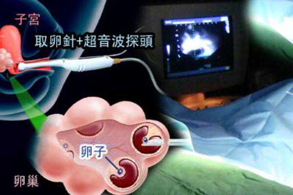 2023年深圳做试管婴儿成功率排名前十的医院有哪