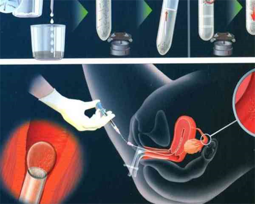 女人吃牛油果有什么好处？6大好处或不请自来，私立供卵