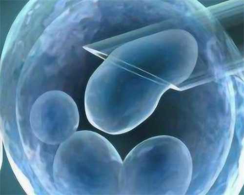 不孕不育检查项目顺序，助孕产子试管