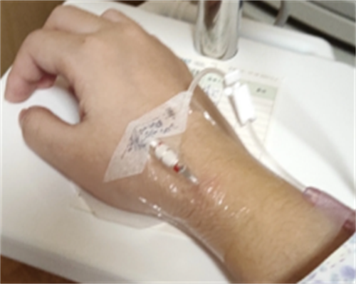 孕妇可以吃莲雾吗？莲雾有什么功效与作用呢？