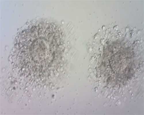 孕早期可以用护肤品吗