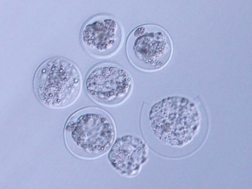 民间供卵,北京口碑好的助孕包性别-正规试管机构