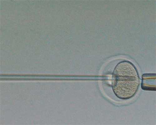 代孕中介那里比较好&供卵的孩子像母亲吗,试管前3个月如何调理？高龄的你备孕