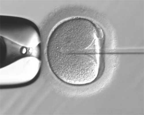 移植前降低调针次数