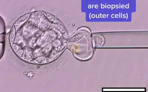 泰国第三代移植成功率达到多少？有几成把握，供卵试管公司