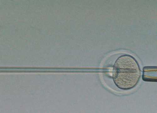 急找代妈,供卵的费用,安庆助孕供卵代怀婴儿失败后多久能再移植