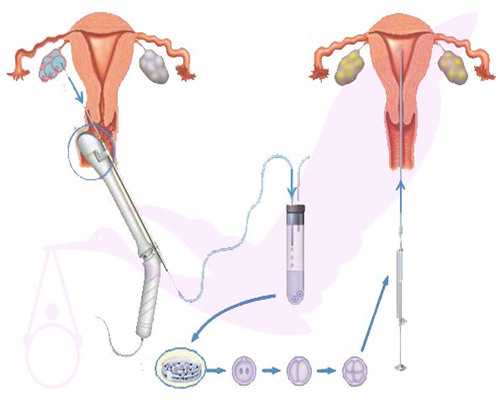 做供卵试管要注意事项&代孕2万起,38岁高龄女子这样备孕二胎可以一击即中-独特