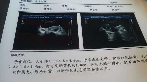 蒲江县39岁供卵试管婴儿的成功率_蒲江县48岁供卵自怀_做试管准妈妈移植34天孕