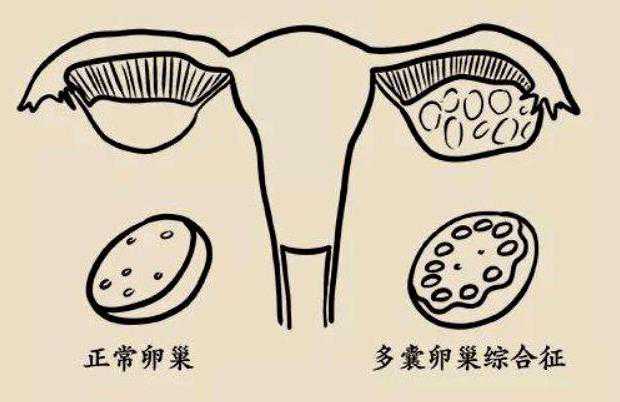 深圳代孕生子便宜 在深圳做试管婴儿花费明细一般是多少 ‘5个月b超女孩生男