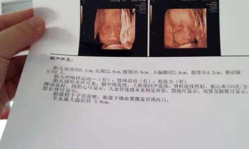 深圳代孕那里最好 深圳试管婴儿私立医院排名如下： ‘b超显示女孩有可能是男